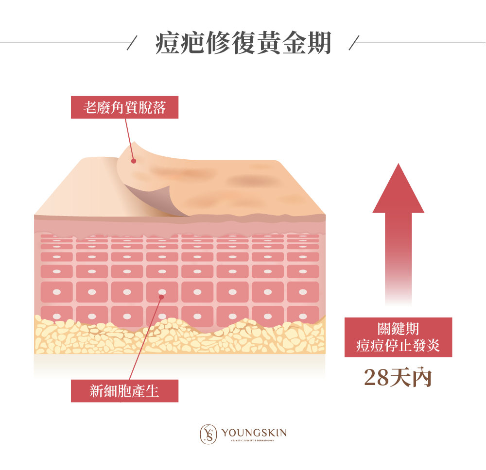 痘疤治療黃金期