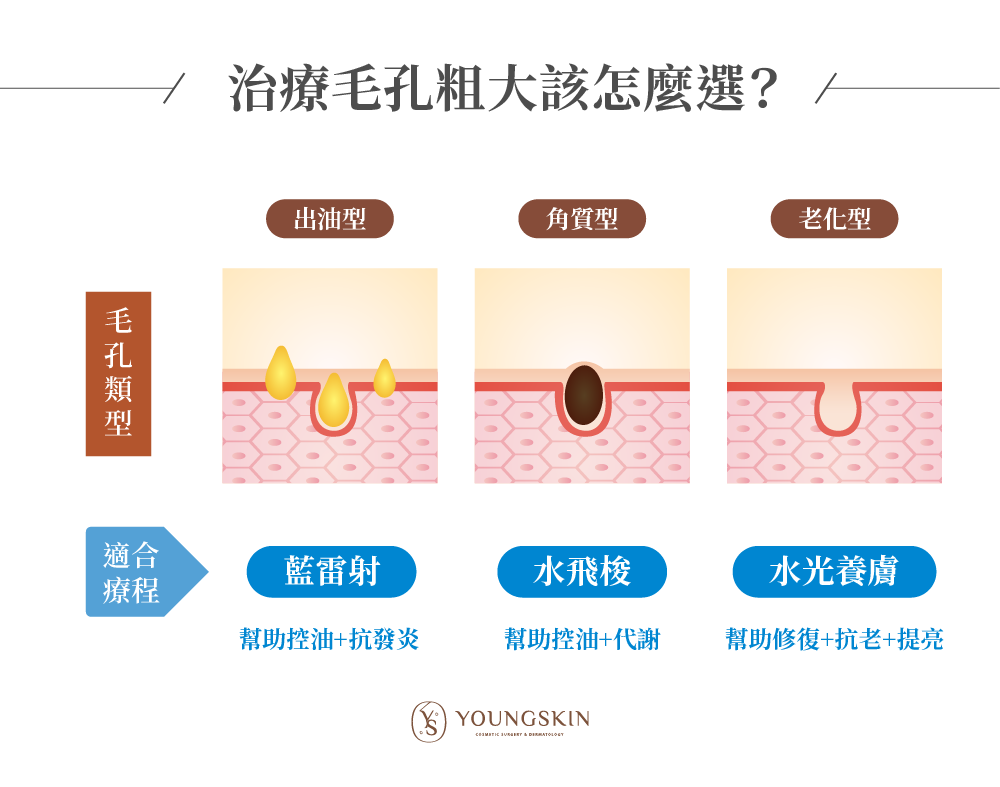 毛孔粗大