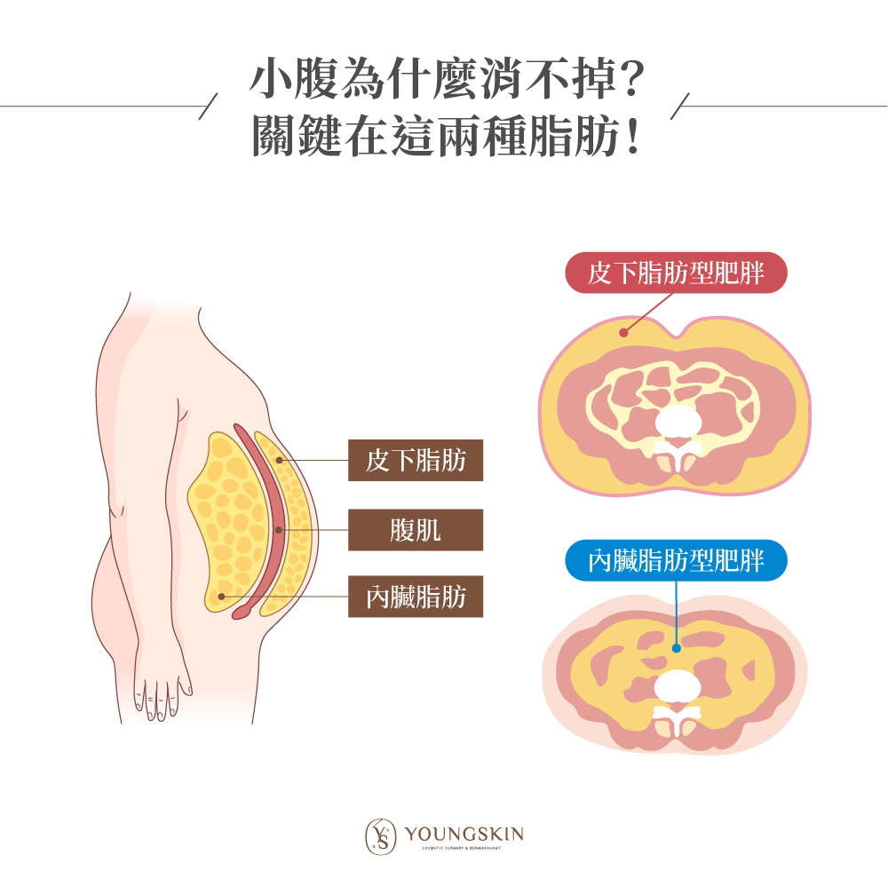 身體脂肪分成皮下脂肪與內臟脂肪