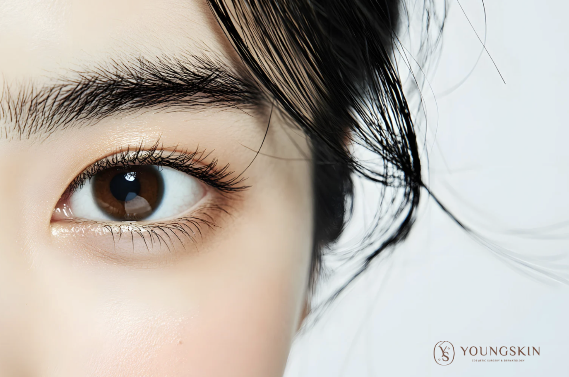 眼周細紋成因到治療