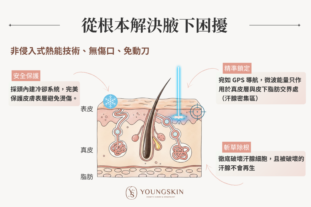 從根本解決腋下困擾